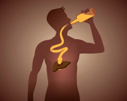 The Effects of Alcohol on the Liver